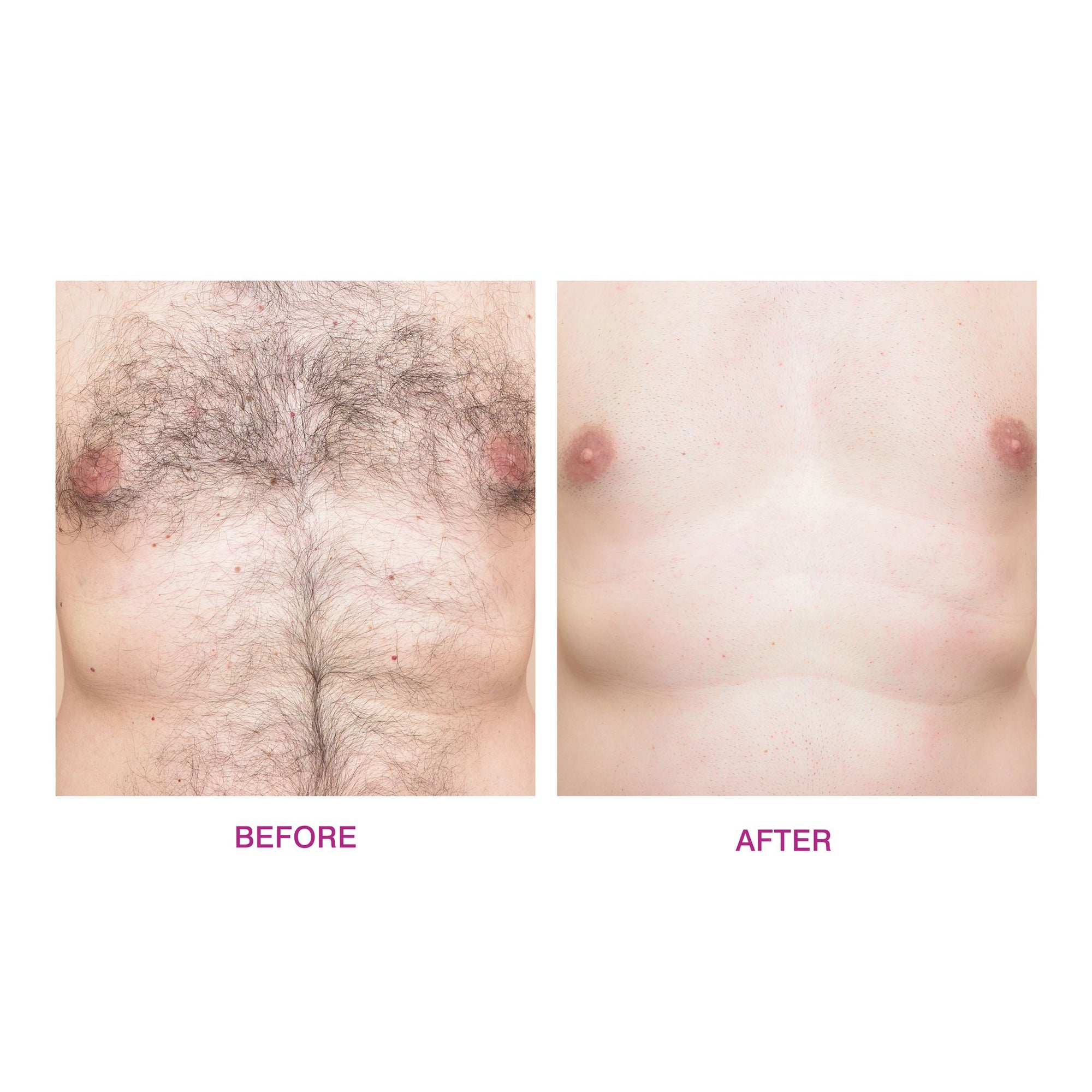 before and after of male chest wax