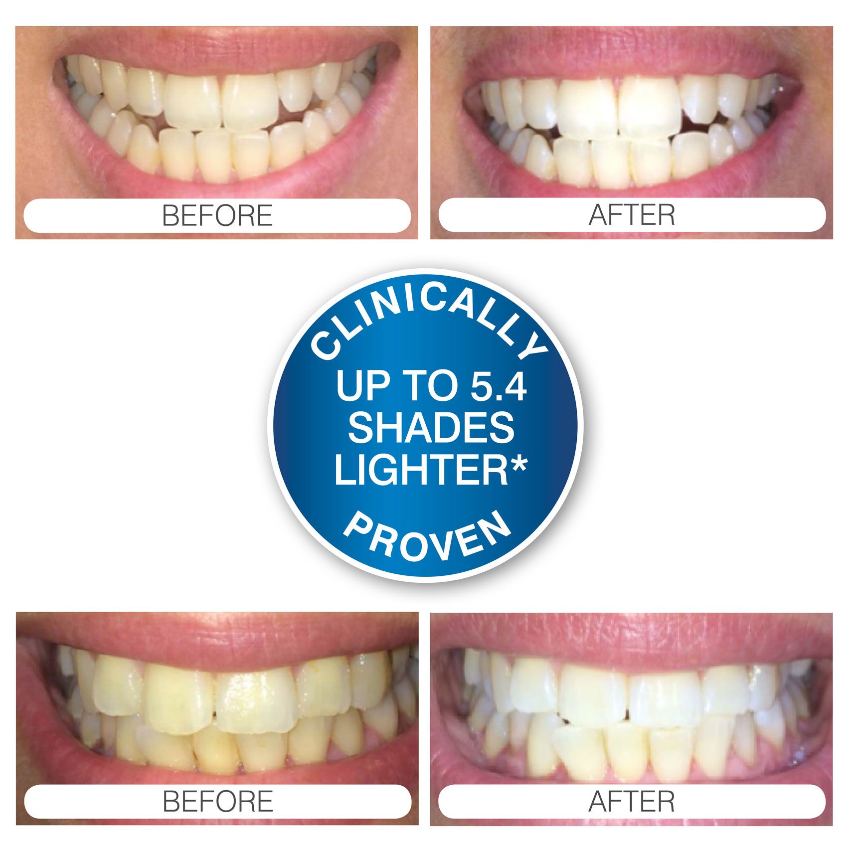 before and after case study images captioned 'clinically proven up to 5.4 shades lighter'